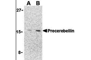 Western Blotting (WB) image for anti-Cerebellin 1 Precursor (CBLN1) (C-Term) antibody (ABIN1030599)