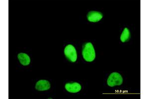 Immunofluorescence of monoclonal antibody to ZNF207 on HeLa cell. (ZNF207 anticorps  (AA 1-110))