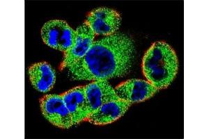 Confocal immunofluorescent analysis of SOCS4 antibody with A2058 cells followed by Alexa Fluor 488-conjugated goat anti-rabbit lgG (green).