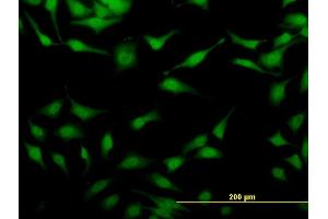 Immunofluorescence of monoclonal antibody to STAU2 on HeLa cell.