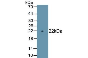 Detection of Recombinant PMP22, Rat using Polyclonal Antibody to Peripheral Myelin Protein 22 (PMP22) (PMP22 anticorps)