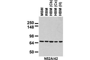 Immunoblot against crude membranes prepared from whole rat (RBM) and mouse (MBM) brain and human cerebral cortex [HBM(Cx)], cerebellum [HBM(Cb)], and hippocampus [HBM(H)] probed with N52A/42 TC supe. (HSPA9 anticorps  (AA 551-766))
