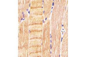 (ABIN6242782 and ABIN6577130) staining CDK5 in human skeletal muscle sections by Immunohistochemistry (IHC-P - paraformaldehyde-fixed, paraffin-embedded sections).