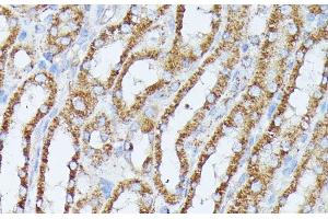 Immunohistochemistry of paraffin-embedded Mouse kidney using PPP2CB Polyclonal Antibody at dilution of 1:100 (40x lens).