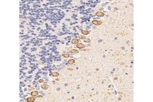 Immunohistochemistry analysis of paraffin-embedded mouse cerebellum using,Dgkz (ABIN7073722) at dilution of 1: 6000