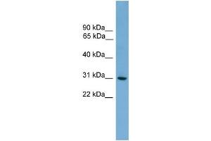 WB Suggested Anti-HLA-DQA2 Antibody Titration:  0.