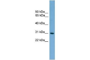 WB Suggested Anti-HLA-DQA2 Antibody Titration:  0. (HLA-DQA2 anticorps  (N-Term))