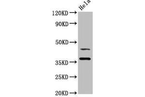 Western Blot Positive WB detected in: Hela whole cell lysate All lanes: DNAJA1 antibody at 3.