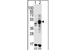 Western blot analysis of GDF9 (arrow) using rabbit polyclonal GDF9 Antibody (M45) (ABIN388822 and ABIN2839140). (GDF9 anticorps  (N-Term))