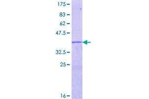 Image no. 1 for Early Growth Response 4 (EGR4) (AA 377-486) protein (GST tag) (ABIN1352459)