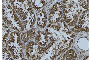 ABIN6275710 at 1/100 staining Mouse testis tissue by IHC-P. (TACC3 anticorps  (C-Term))