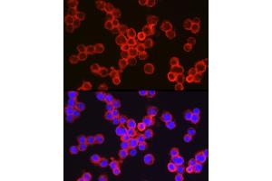 Immunofluorescence analysis of TF-1 cells using CD11b/ITGAM Rabbit pAb (ABIN3022179, ABIN3022180, ABIN3022181 and ABIN6218650) at dilution of 1:100 (40x lens).