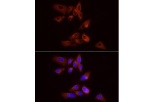 Immunofluorescence analysis of PC-3 cells using PYGB Rabbit pAb  at dilution of 1:100 (40x lens). (PYGB anticorps  (AA 544-843))