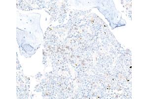 Immunohistochemistry (IHC) image for anti-CD22 Molecule (CD22) (AA 750-800) antibody (ABIN7795736) (Recombinant CD22 anticorps  (AA 750-800))