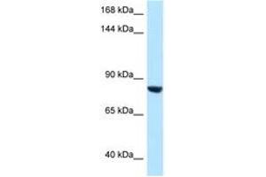 Image no. 1 for anti-Dapper, Antagonist of beta-Catenin, Homolog 1 (DACT1) (AA 673-722) antibody (ABIN6747917)