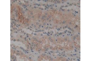 Used in DAB staining on fromalin fixed paraffin- embedded Kidney tissue (PTPRK anticorps  (AA 1185-1440))