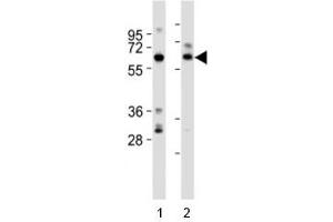 Western blot testing of SOX11 antibody at 1:2000 dilution.