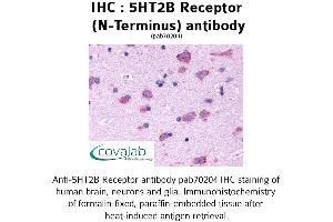 Image no. 1 for anti-Serotonin Receptor 2B (HTR2B) (Extracellular Domain), (N-Term) antibody (ABIN1731365) (Serotonin Receptor 2B anticorps  (Extracellular Domain, N-Term))