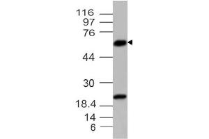 Image no. 1 for anti-Parathyroid Hormone (PTH) (AA 1-236) antibody (ABIN5027427) (PTH anticorps  (AA 1-236))