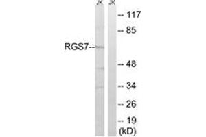 Western blot analysis of extracts from Jurkat cells, using RGS7 Antibody. (RGS7 anticorps  (AA 155-204))