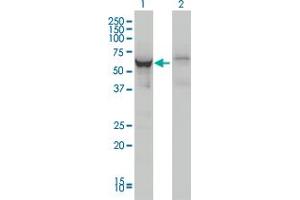 Western Blot analysis of DDX56 expression in transfected 293T cell line by DDX56 monoclonal antibody (M05), clone 4C5. (DDX56 anticorps  (AA 450-547))