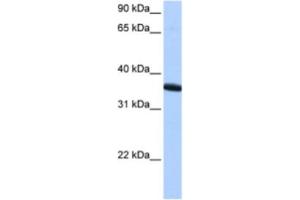 Western Blotting (WB) image for anti-Zinc Finger Protein 192 Pseudogene 1 (ZNF192P1) antibody (ABIN2463407) (ZNF192P1 anticorps)