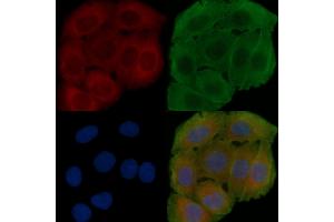 ABIN6262446 and ABIN6278479 staining Hela cells(30 min of UV treatment) by IF/ICC. (IDH3B anticorps  (N-Term))