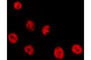 ABIN6275789 staining HepG2 by IF/ICC.