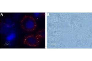 Expression of PAR-1 in human prostate PC-3 cell line - Cell surface detection of PAR-1 in human prostate PC-3 cell line.