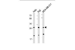 All lanes : Anti-RAB12 Antibody (N-term) at 1:2000 dilution Lane 1: Hela whole cell lysate Lane 2: Raji whole cell lysate Lane 3: MDA-MB-231 whole cell lysate Lysates/proteins at 20 μg per lane. (RAB12 anticorps  (N-Term))