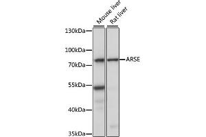 Western blot analysis of extracts of various cell lines, using ARSE antibody (ABIN7265688) at 1:1000 dilution. (Arylsulfatase E anticorps  (AA 520-589))