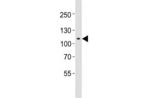 Western blot testing of Mertk antibody at 1:1000 dilution + mouse spleen lysate; Predicted molecular weight: 110~205 kDa depending on glycosylation level (MERTK anticorps  (C-Term))