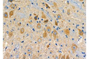 ABIN6265688 and ABIN6278646 at 1/100 staining Mouse brain tissue by IHC-P.