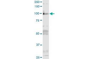 Immunoprecipitation of ITGB6 transfected lysate using anti-ITGB6 MaxPab rabbit polyclonal antibody and Protein A Magnetic Bead , and immunoblotted with ITGB6 purified MaxPab mouse polyclonal antibody (B01P) .