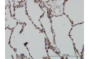 anti-serum/glucocorticoid Regulated Kinase 1 (SGK1) (AA 1-90) antibody