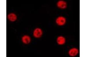 ABIN6277875 staining 293T by IF/ICC.