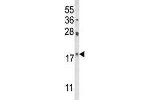 Western blot analysis of PIN1 antibody and HL-60 lysate