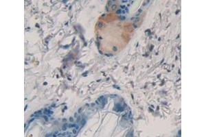 Used in DAB staining on fromalin fixed paraffin- embedded Kidney tissue (Keratin 2 anticorps  (AA 200-508))