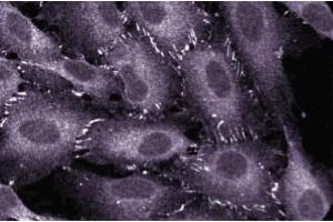 Immunofluorescent staining of EAHY human endothelial cells. (TJP1 anticorps  (AA 1048-1247))