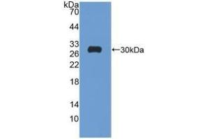 Detection of Recombinant GR, Rat using Polyclonal Antibody to Glutathione Reductase (GR) (Glutathione Reductase anticorps  (AA 7-246))
