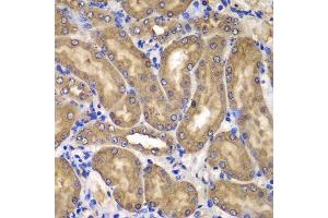 Immunohistochemistry of paraffin-embedded mouse kidney using NME2 antibody.