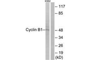 Western blot analysis of extracts from K562 cells, treated with serum 10 % 15', using Cyclin B1 (Ab-126) Antibody.