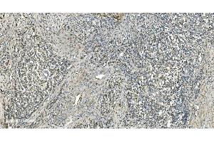 IHC analysis of LSM7 using anti-LSM7 antibody (ABIN7598937). (LSM7 anticorps  (AA 1-103))