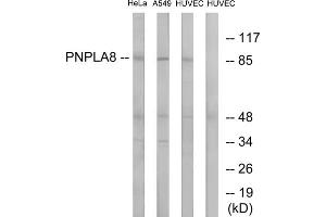 Western blot analysis of extracts from HeLa cells, A549 cells and HUVEC cells, using PNPLA8 antibody. (PNPLA8 anticorps  (C-Term))
