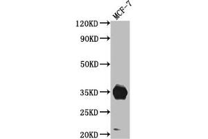 Western Blot Positive WB detected in: MCF-7 whole cell lysate All lanes: IGFBP2 antibody at 1:1000 Secondary Goat polyclonal to rabbit IgG at 1/50000 dilution Predicted band size: 35 kDa Observed band size: 35 kDa (Recombinant IGFBP2 anticorps)