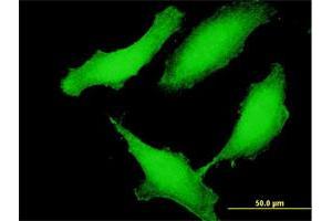 Immunofluorescence of purified MaxPab antibody to CCDC115 on HeLa cell. (CCDC115 anticorps  (AA 1-180))