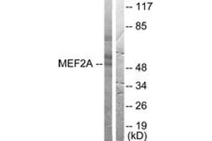 Western blot analysis of extracts from HeLa cells, treated with PMA 125ng/ml 30', using MEF2A (Ab-408) Antibody.