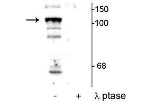 Western blot of mouse testicular lysate showing specific immunolabeling of the ~104 kDa PTPH1 phosphorylated at Ser459 in the first lane (-). (PTPN3 anticorps  (pSer459))