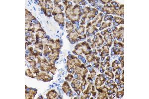 Immunohistochemistry of paraffin-embedded rat pancreas using RPS3 Rabbit pAb (ABIN3023342, ABIN3023343, ABIN3023344 and ABIN6219623) at dilution of 1:100 (40x lens).