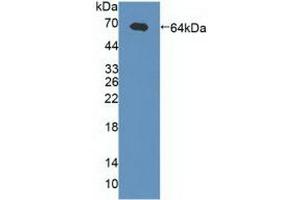 Detection of Recombinant gABRa2, Human using Polyclonal Antibody to Gamma-Aminobutyric Acid A Receptor Alpha 2 (gABRa2)